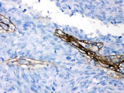 2 - Anti-Collagen I Picoband Antibody ABO12623