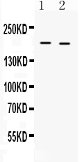 1 - Anti-Collagen I Picoband Antibody ABO12624