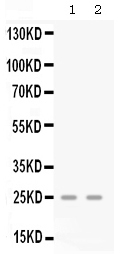 1 - Anti-CXCL3 Picoband Antibody ABO12626