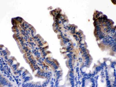 2 - Anti-FABP2/I-FABP Picoband Antibody ABO12628