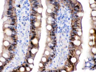 2 - Anti-FABP2/I-FABP Picoband Antibody ABO12628