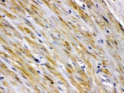 2 - Anti-FABP2/I-FABP Picoband Antibody ABO12628