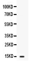 1 - Anti-FABP2/I-FABP Picoband Antibody ABO12628