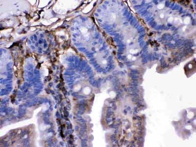 2 - Anti-FGF1 Picoband Antibody ABO12629