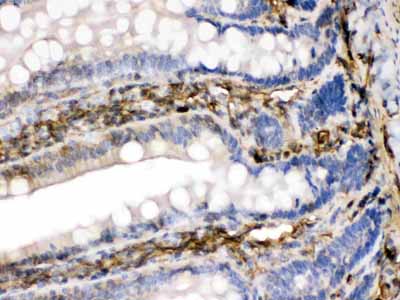 2 - Anti-FGF1 Picoband Antibody ABO12629