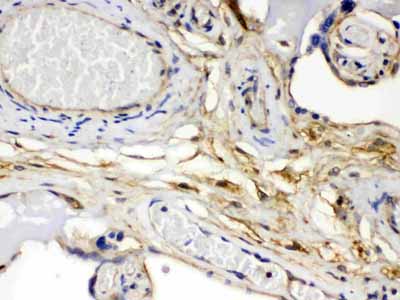 2 - Anti-FGF1 Picoband Antibody ABO12629