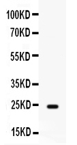 1 - Anti-FGF1 Picoband Antibody ABO12629