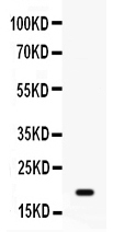 1 - Anti-GADD45A Picoband Antibody ABO12630