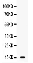 1 - Anti-GIP Picoband Antibody ABO12631