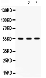 1 - Anti-Integrin linked ILK Picoband Antibody ABO12634