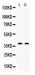 1 - Anti-Galectin-4 Picoband Antibody ABO12637