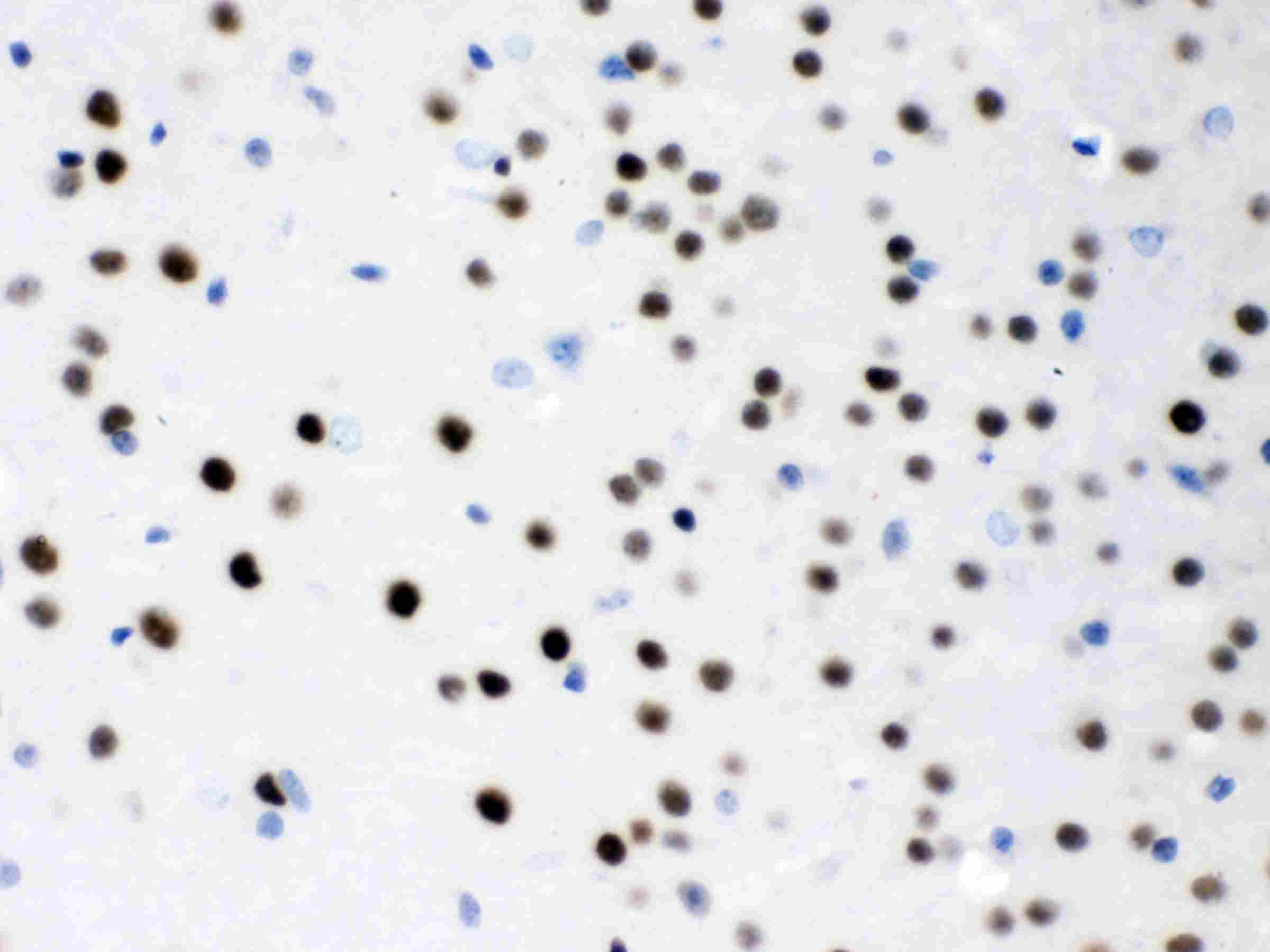 2 - Anti-MEF2A Picoband Antibody ABO12638