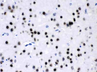 2 - Anti-MEF2A Picoband Antibody ABO12638