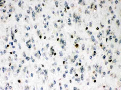 2 - Anti-MEF2A Picoband Antibody ABO12638