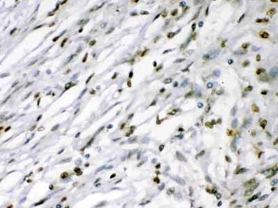 2 - Anti-MEF2A Picoband Antibody ABO12638