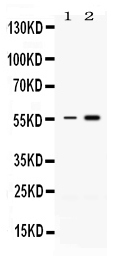 1 - Anti-MEF2A Picoband Antibody ABO12638