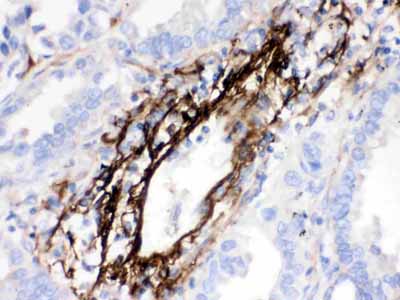 2 - Anti-MGP Picoband Antibody ABO12639