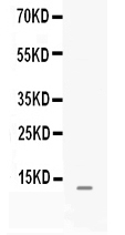 1 - Anti-MGP Picoband Antibody ABO12639