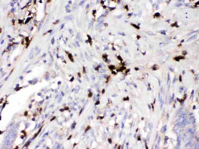 2 - Anti-AGP1/alpha 1 acid glycoprotein Picoband Antibody ABO12641