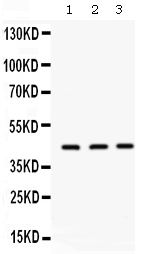 1 - Anti-AGP1/alpha 1 acid glycoprotein Picoband Antibody ABO12641