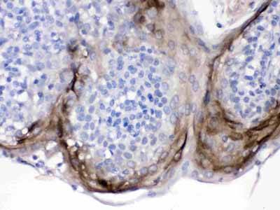 2 - Anti-Elafin/PI3 Picoband Antibody ABO12642
