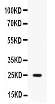 1 - Anti-Elafin/PI3 Picoband Antibody ABO12642