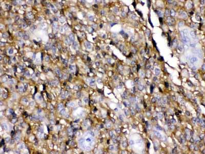 2 - Anti-EAAT1 Picoband Antibody ABO12644
