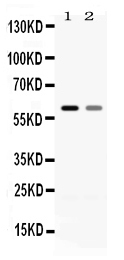 1 - Anti-EAAT1 Picoband Antibody ABO12644