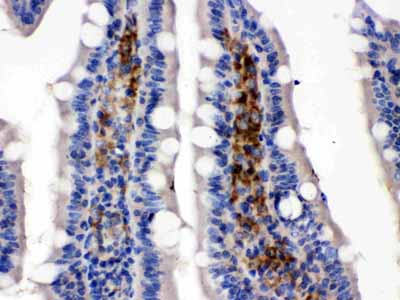 2 - Anti-SLC2A5 Picoband Antibody ABO12645