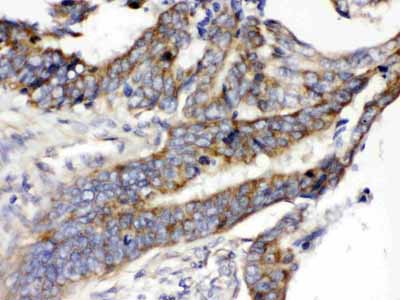 2 - Anti-SLC2A5 Picoband Antibody ABO12645