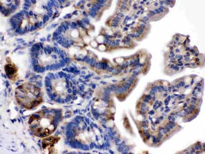 2 - Anti-Talin 2 Picoband Antibody ABO12646