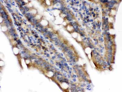 2 - Anti-Talin 2 Picoband Antibody ABO12646
