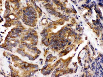 2 - Anti-Talin 2 Picoband Antibody ABO12646