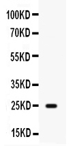 1 - Anti-HE4 Picoband Antibody ABO12648