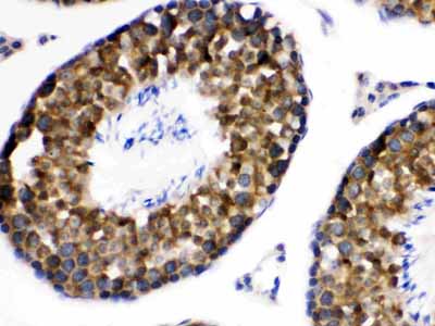 2 - Anti-WNK1 Picoband Antibody ABO12649