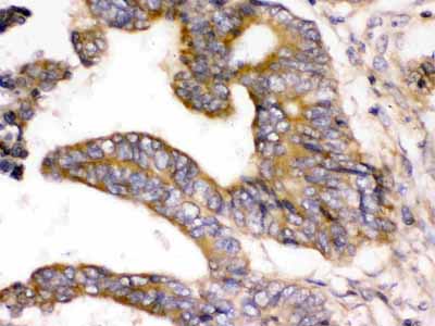 2 - Anti-WNK1 Picoband Antibody ABO12649