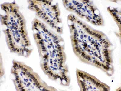 2 - Anti-CRM1 Picoband Antibody ABO12651