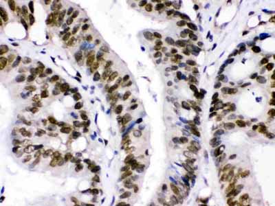 2 - Anti-CRM1 Picoband Antibody ABO12651