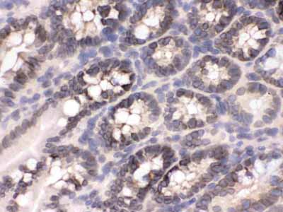 2 - Anti-CRM1 Picoband Antibody ABO12651