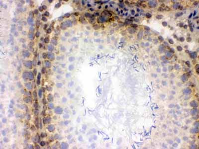 2 - Anti-CRM1 Picoband Antibody ABO12651