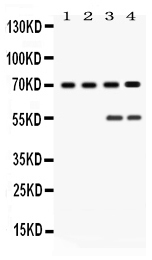 1 - Anti-YAP1 Picoband Antibody ABO12652