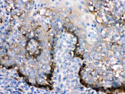 2 - Anti-ZAP70 Picoband Antibody ABO12653