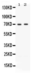 1 - Anti-ZAP70 Picoband Antibody ABO12653