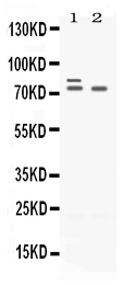 1 - Anti-Plzf Picoband Antibody ABO12654