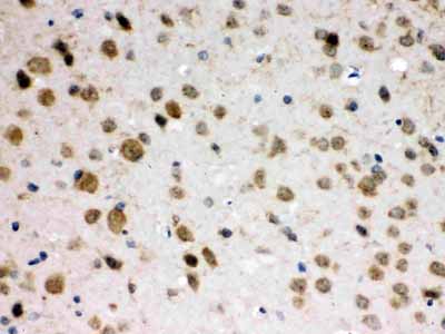 2 - Anti-ABR Picoband Antibody ABO12657