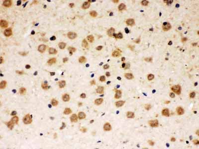 2 - Anti-ABR Picoband Antibody ABO12657
