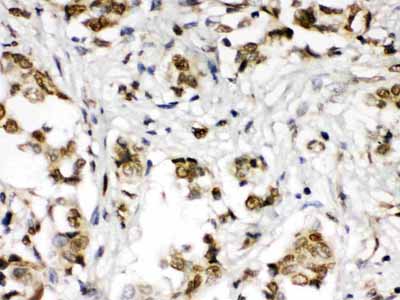 2 - Anti-ABR Picoband Antibody ABO12657