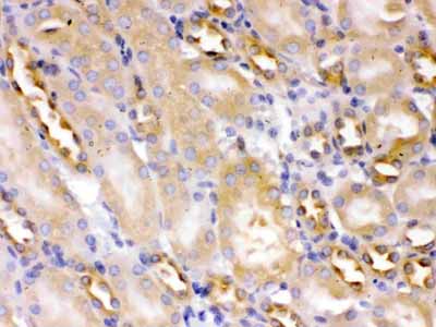 2 - Anti-Alpha Actinin 4 Picoband Antibody ABO12659