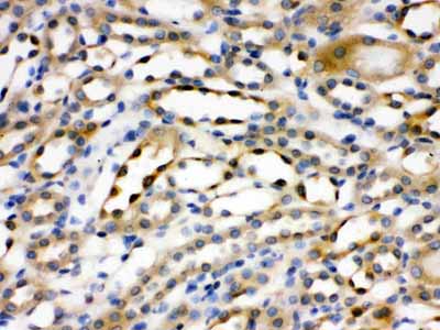 2 - Anti-Alpha Actinin 4 Picoband Antibody ABO12659