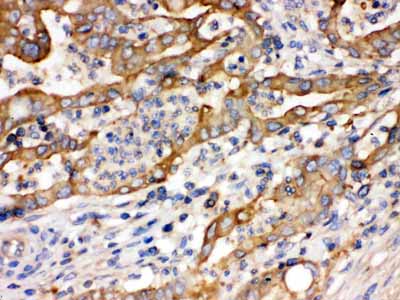 2 - Anti-Alpha Actinin 4 Picoband Antibody ABO12659